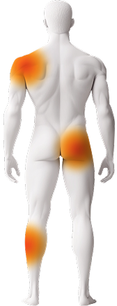 Injury Back Image